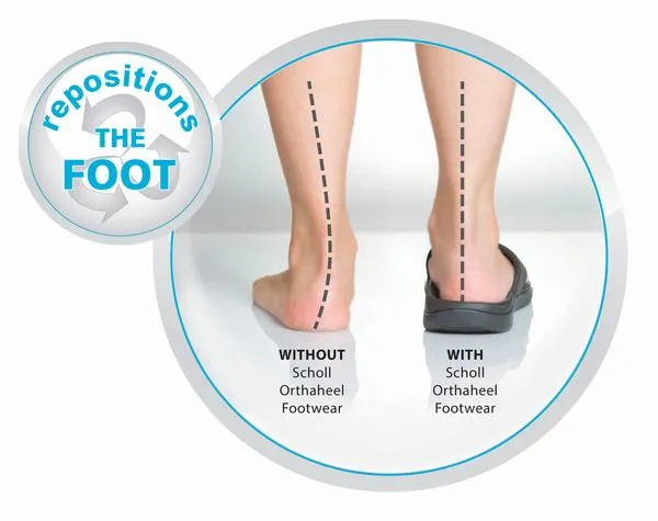 Chaussons d'intérieur confortables et réglables pour femmes Scholl Orthaheel Easyfit - Chaussures Scholl Orthaheel